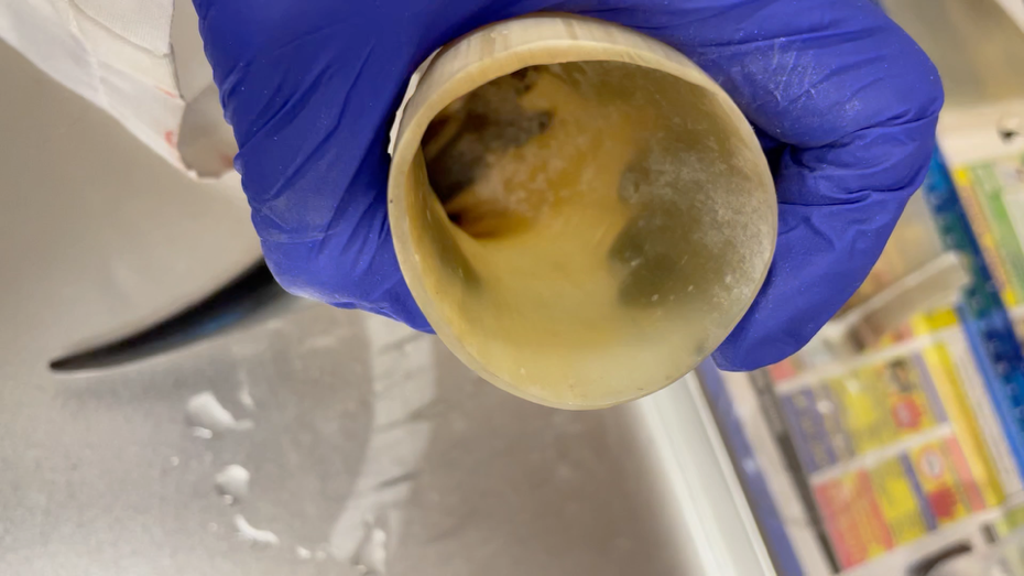 A hand in blue glove holding a round object